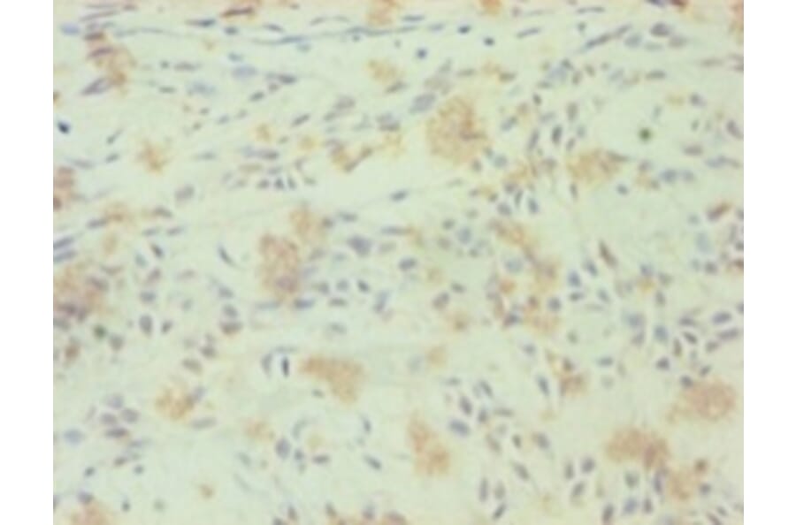 Immunohistochemistry - Nuclear receptor ROR-gamma Polyclonal Antibody from Signalway Antibody - Antibodies.com