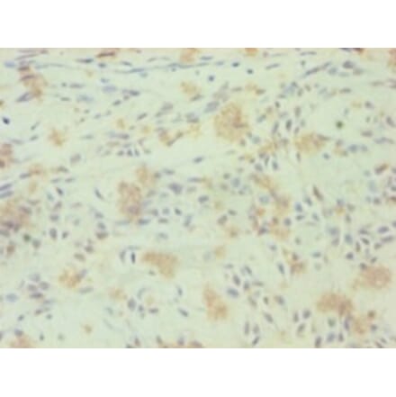 Immunohistochemistry - Nuclear receptor ROR-gamma Polyclonal Antibody from Signalway Antibody - Antibodies.com