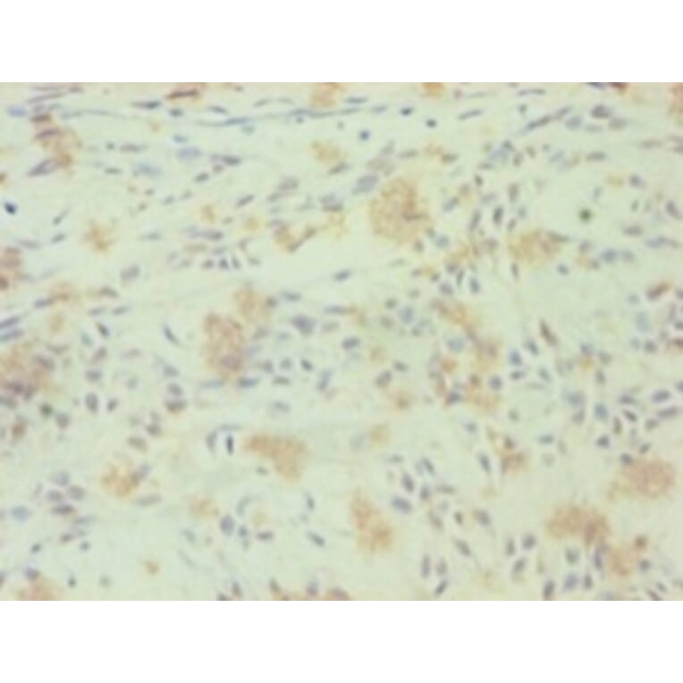 Immunohistochemistry - Nuclear receptor ROR-gamma Polyclonal Antibody from Signalway Antibody - Antibodies.com