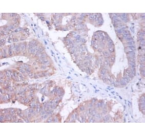 Immunohistochemistry - AP-2 complex subunit sigma Polyclonal Antibody from Signalway Antibody - Antibodies.com