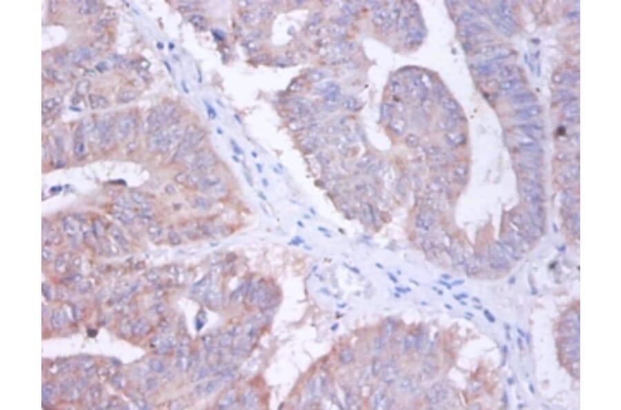 Immunohistochemistry - AP-2 complex subunit sigma Polyclonal Antibody from Signalway Antibody - Antibodies.com