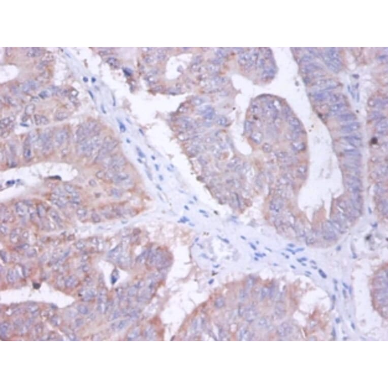 Immunohistochemistry - AP-2 complex subunit sigma Polyclonal Antibody from Signalway Antibody - Antibodies.com