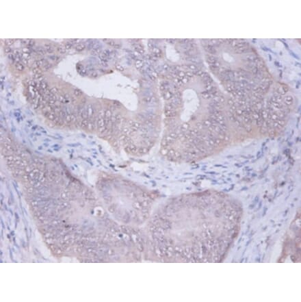 Immunohistochemistry - Glucosidase 2 subunit beta Polyclonal Antibody from Signalway Antibody - Antibodies.com