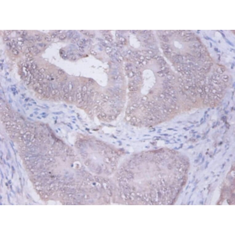Immunohistochemistry - Glucosidase 2 subunit beta Polyclonal Antibody from Signalway Antibody - Antibodies.com