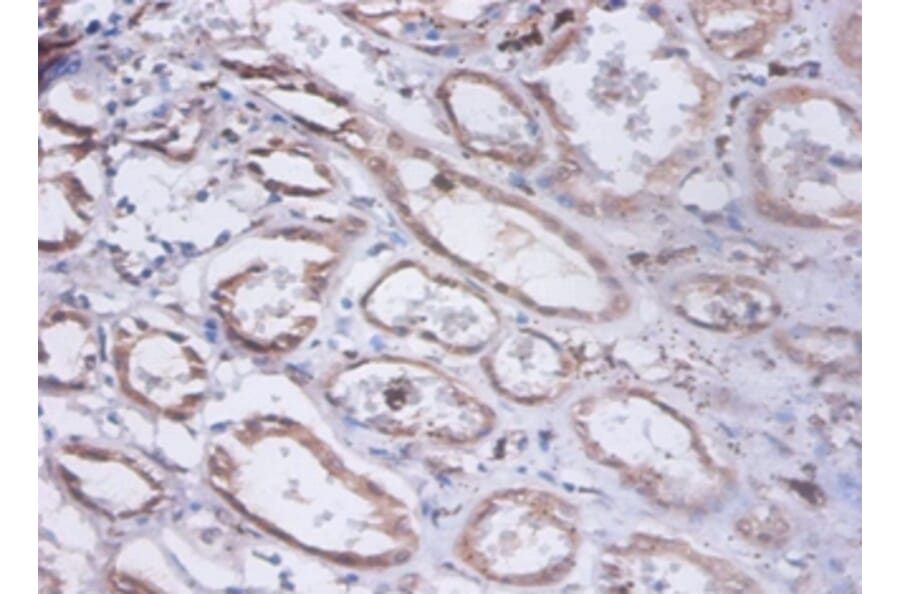 Immunohistochemistry - Glucosidase 2 subunit beta Polyclonal Antibody from Signalway Antibody - Antibodies.com