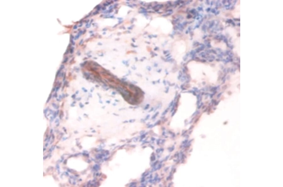 Immunohistochemistry - Collagen alpha-1 (IV) chain Polyclonal Antibody from Signalway Antibody - Antibodies.com