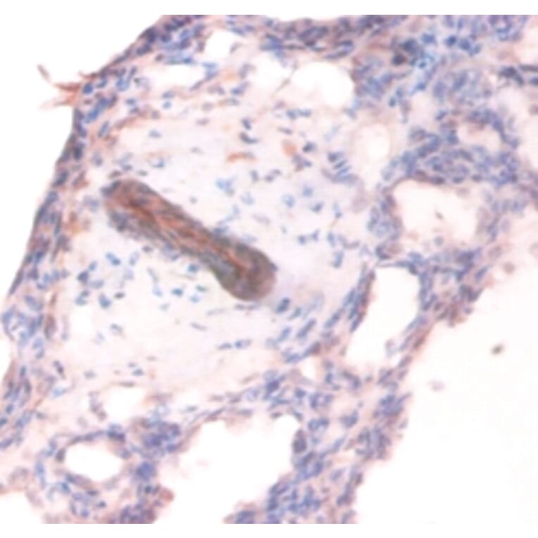 Immunohistochemistry - Collagen alpha-1 (IV) chain Polyclonal Antibody from Signalway Antibody - Antibodies.com