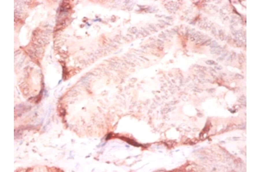 Immunohistochemistry - Collagen alpha-2 (IV) chain Polyclonal Antibody from Signalway Antibody - Antibodies.com