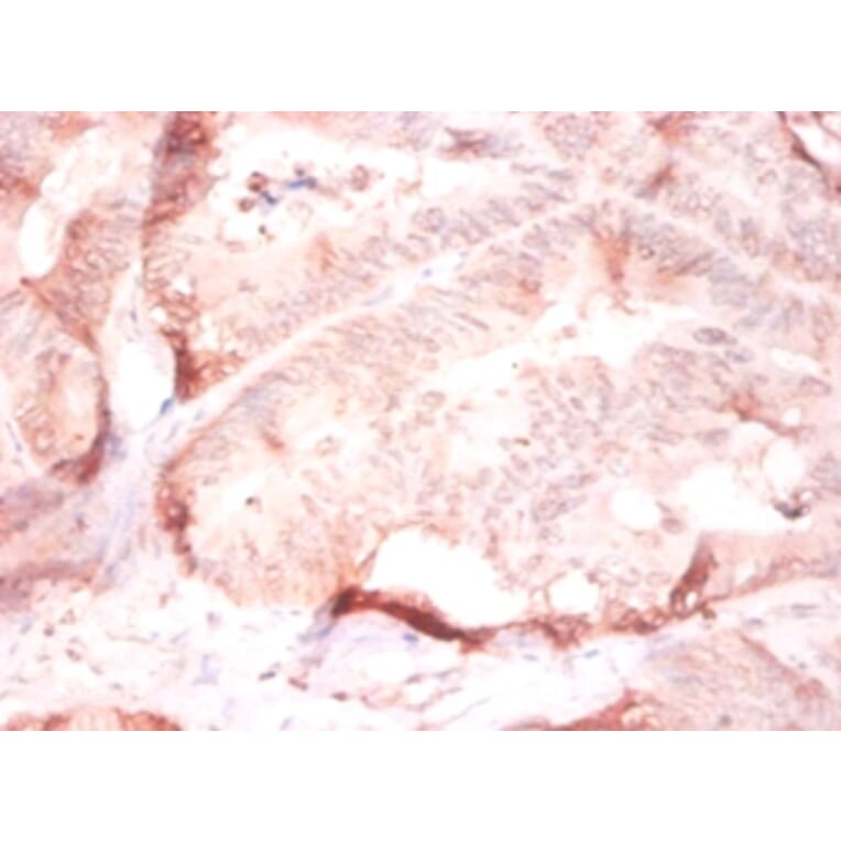 Immunohistochemistry - Collagen alpha-2 (IV) chain Polyclonal Antibody from Signalway Antibody - Antibodies.com