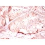 Immunohistochemistry - Collagen alpha-2 (IV) chain Polyclonal Antibody from Signalway Antibody - Antibodies.com