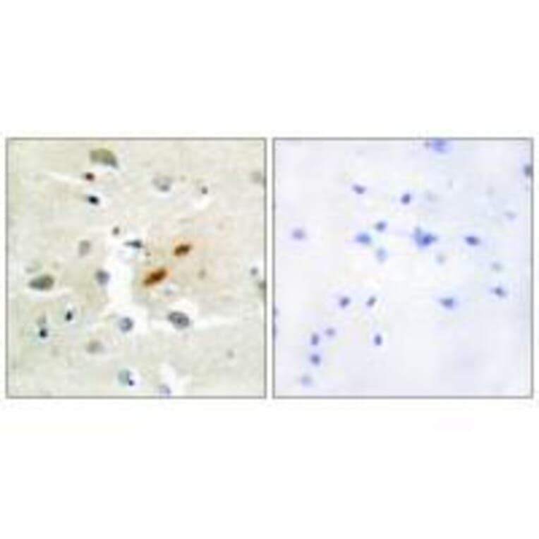 Immunohistochemistry - DNA Polymerase ζ Antibody from Signalway Antibody (33602) - Antibodies.com