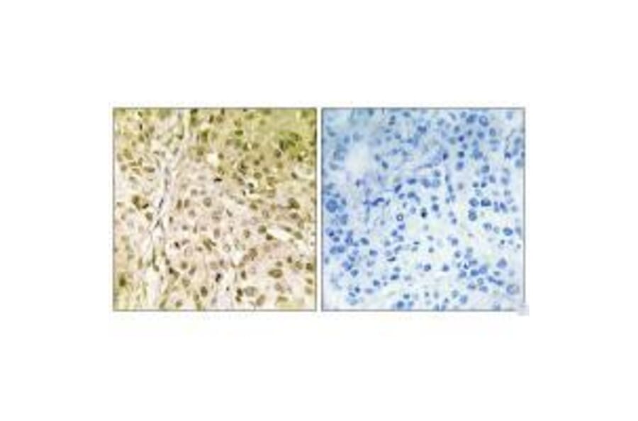 Immunohistochemistry - DNA Polymerase θ Antibody from Signalway Antibody (33611) - Antibodies.com