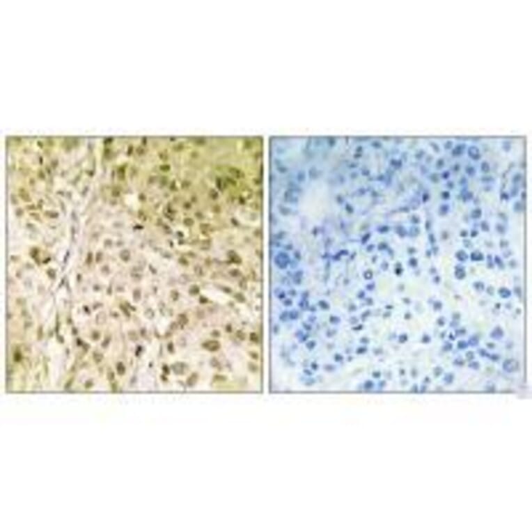 Immunohistochemistry - DNA Polymerase θ Antibody from Signalway Antibody (33611) - Antibodies.com