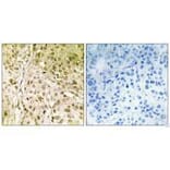 Immunohistochemistry - DNA Polymerase θ Antibody from Signalway Antibody (33611) - Antibodies.com
