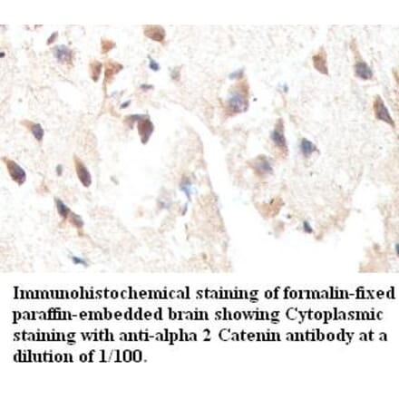 alpha 2 Catenin Antibody from Signalway Antibody (39413) - Antibodies.com