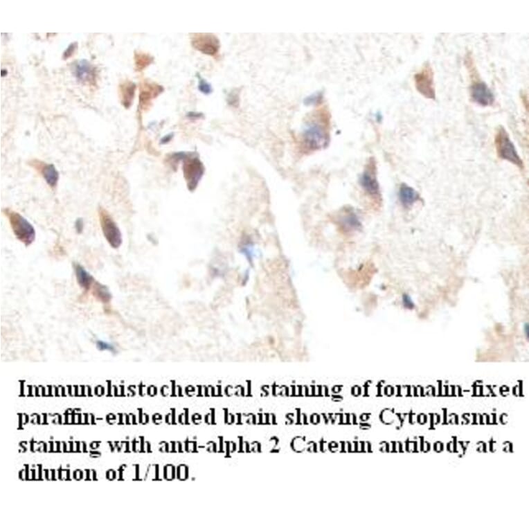 alpha 2 Catenin Antibody from Signalway Antibody (39413) - Antibodies.com