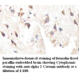 alpha 2 Catenin Antibody from Signalway Antibody (39413) - Antibodies.com