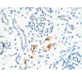 Kif 7 Monoclonal Antibody from Signalway Antibody (40437) - Antibodies.com