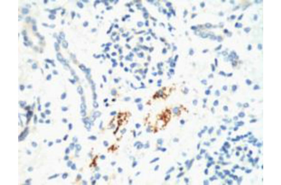Kif 7 Monoclonal Antibody from Signalway Antibody (40437) - Antibodies.com