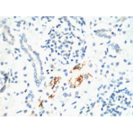 Kif 7 Monoclonal Antibody from Signalway Antibody (40437) - Antibodies.com
