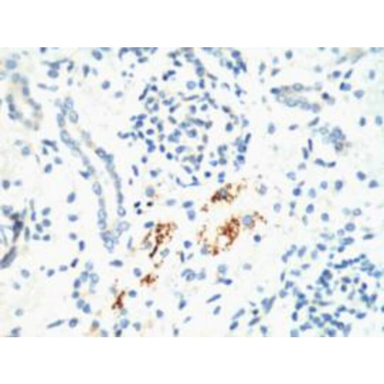 Kif 7 Monoclonal Antibody from Signalway Antibody (40437) - Antibodies.com