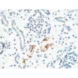 Kif 7 Monoclonal Antibody from Signalway Antibody (40437) - Antibodies.com