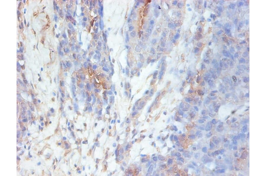 Immunohistochemistry - GAL-3 Monoclonal Antibody from Signalway Antibody (42023) - Antibodies.com