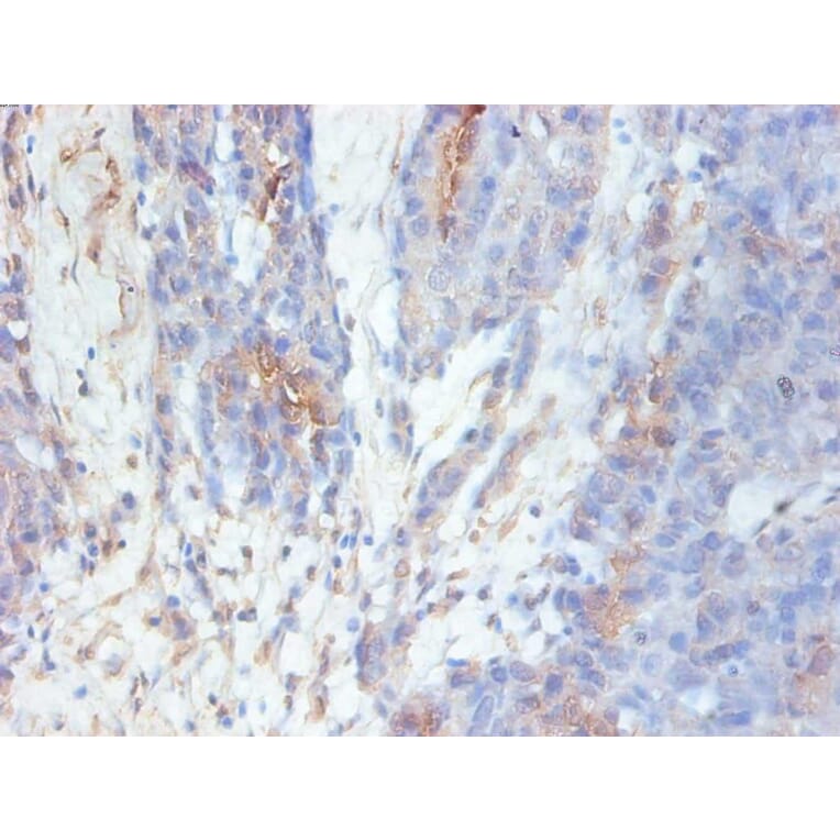 Immunohistochemistry - GAL-3 Monoclonal Antibody from Signalway Antibody (42023) - Antibodies.com