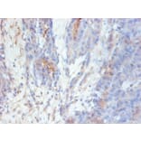Immunohistochemistry - GAL-3 Monoclonal Antibody from Signalway Antibody (42023) - Antibodies.com