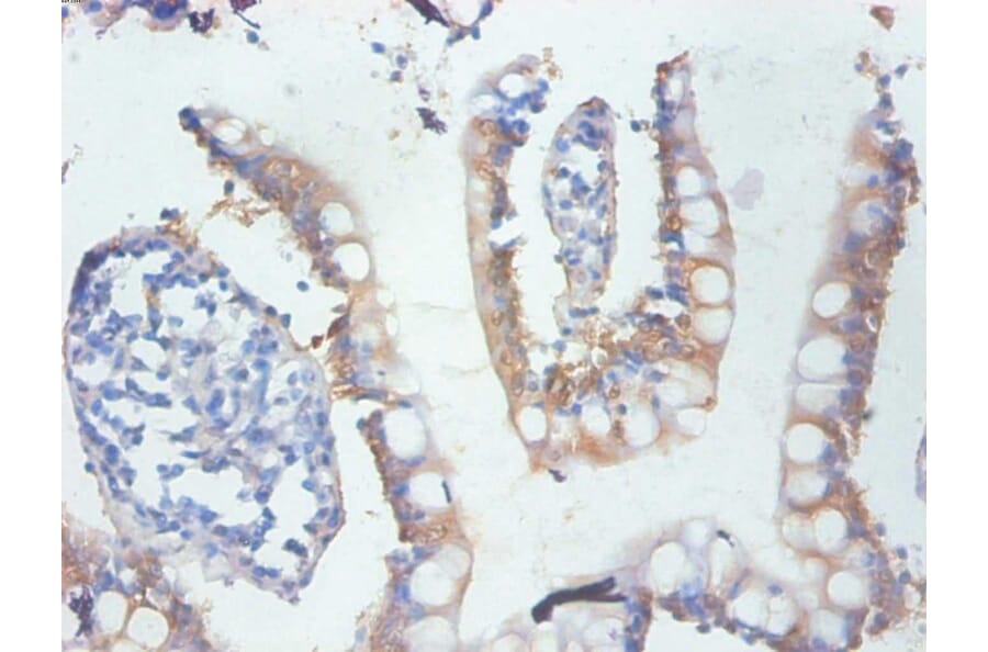 Immunohistochemistry - GAL-3 Monoclonal Antibody from Signalway Antibody (42023) - Antibodies.com