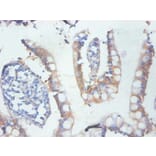 Immunohistochemistry - GAL-3 Monoclonal Antibody from Signalway Antibody (42023) - Antibodies.com