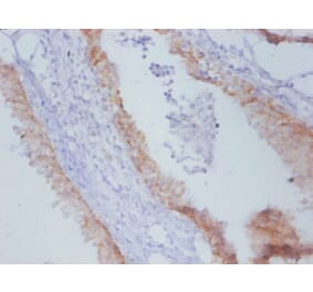 Immunohistochemistry - Timp1 Monoclonal Antibody from Signalway Antibody (42048) - Antibodies.com
