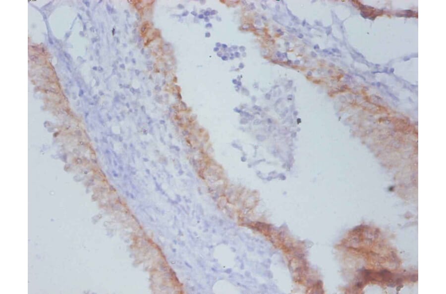 Immunohistochemistry - Timp1 Monoclonal Antibody from Signalway Antibody (42048) - Antibodies.com