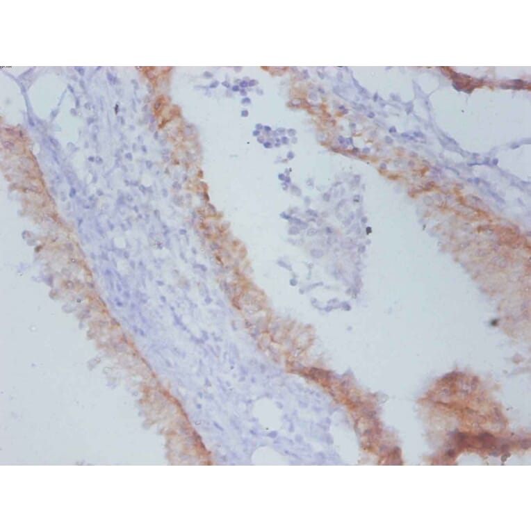 Immunohistochemistry - Timp1 Monoclonal Antibody from Signalway Antibody (42048) - Antibodies.com