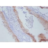Immunohistochemistry - Timp1 Monoclonal Antibody from Signalway Antibody (42048) - Antibodies.com