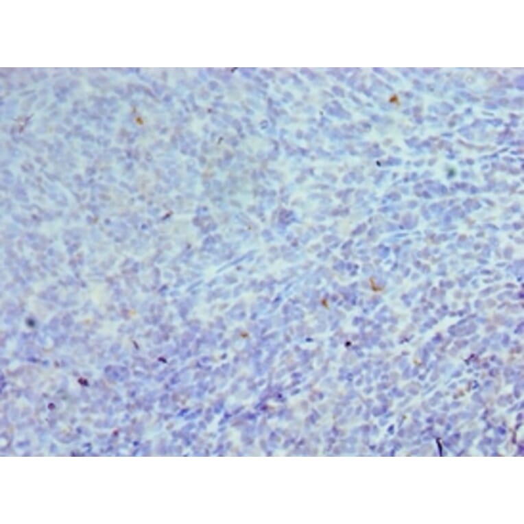 Immunohistochemistry - CEBPG Polyclonal Antibody from Signalway Antibody (42118) - Antibodies.com