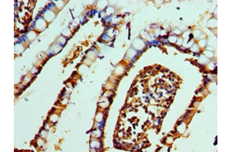 Immunohistochemistry - DEFA1 Polyclonal Antibody from Signalway Antibody (42145) - Antibodies.com