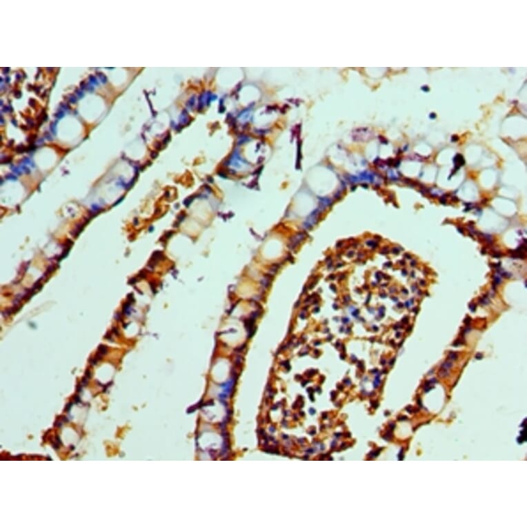 Immunohistochemistry - DEFA1 Polyclonal Antibody from Signalway Antibody (42145) - Antibodies.com