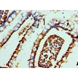 Immunohistochemistry - DEFA1 Polyclonal Antibody from Signalway Antibody (42145) - Antibodies.com