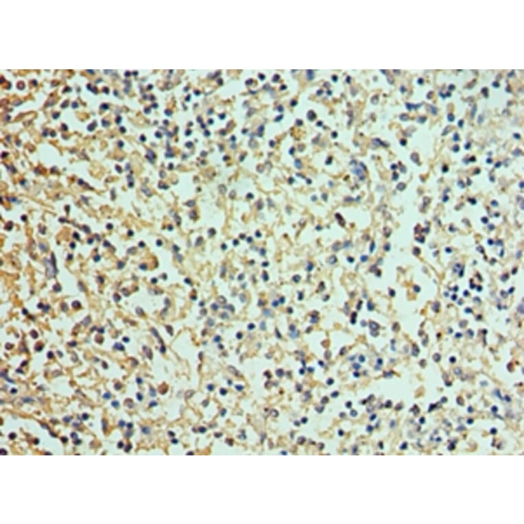 Immunohistochemistry - DEFA1 Polyclonal Antibody from Signalway Antibody (42145) - Antibodies.com