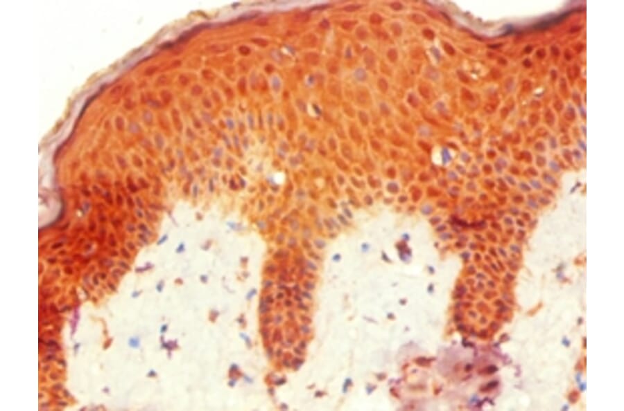 Immunohistochemistry - HOXB7 Polyclonal Antibody from Signalway Antibody (42212) - Antibodies.com