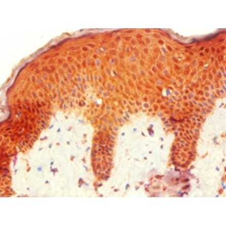 Immunohistochemistry - HOXB7 Polyclonal Antibody from Signalway Antibody (42212) - Antibodies.com