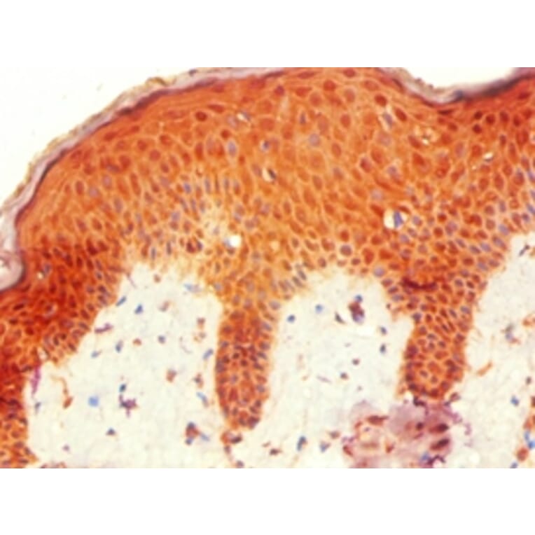 Immunohistochemistry - HOXB7 Polyclonal Antibody from Signalway Antibody (42212) - Antibodies.com