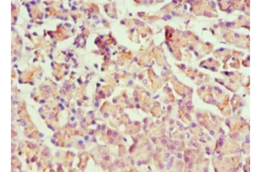 Immunohistochemistry - HOXB7 Polyclonal Antibody from Signalway Antibody (42212) - Antibodies.com