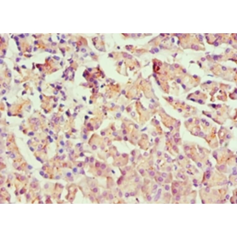Immunohistochemistry - HOXB7 Polyclonal Antibody from Signalway Antibody (42212) - Antibodies.com