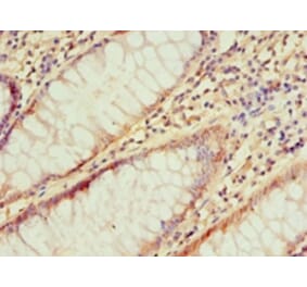 Immunohistochemistry - IRAK2 Polyclonal Antibody from Signalway Antibody (42225) - Antibodies.com