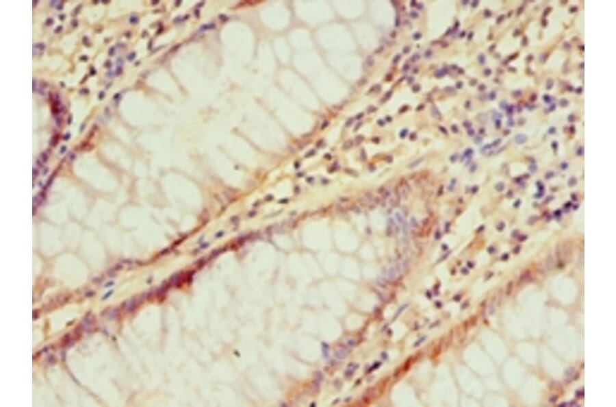 Immunohistochemistry - IRAK2 Polyclonal Antibody from Signalway Antibody (42225) - Antibodies.com