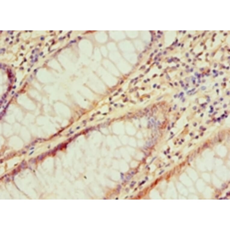 Immunohistochemistry - IRAK2 Polyclonal Antibody from Signalway Antibody (42225) - Antibodies.com