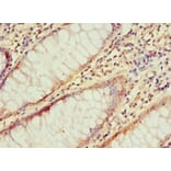 Immunohistochemistry - IRAK2 Polyclonal Antibody from Signalway Antibody (42225) - Antibodies.com