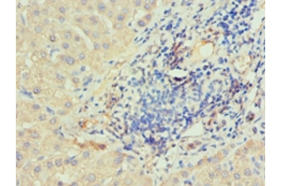 Immunohistochemistry - IRAK2 Polyclonal Antibody from Signalway Antibody (42225) - Antibodies.com